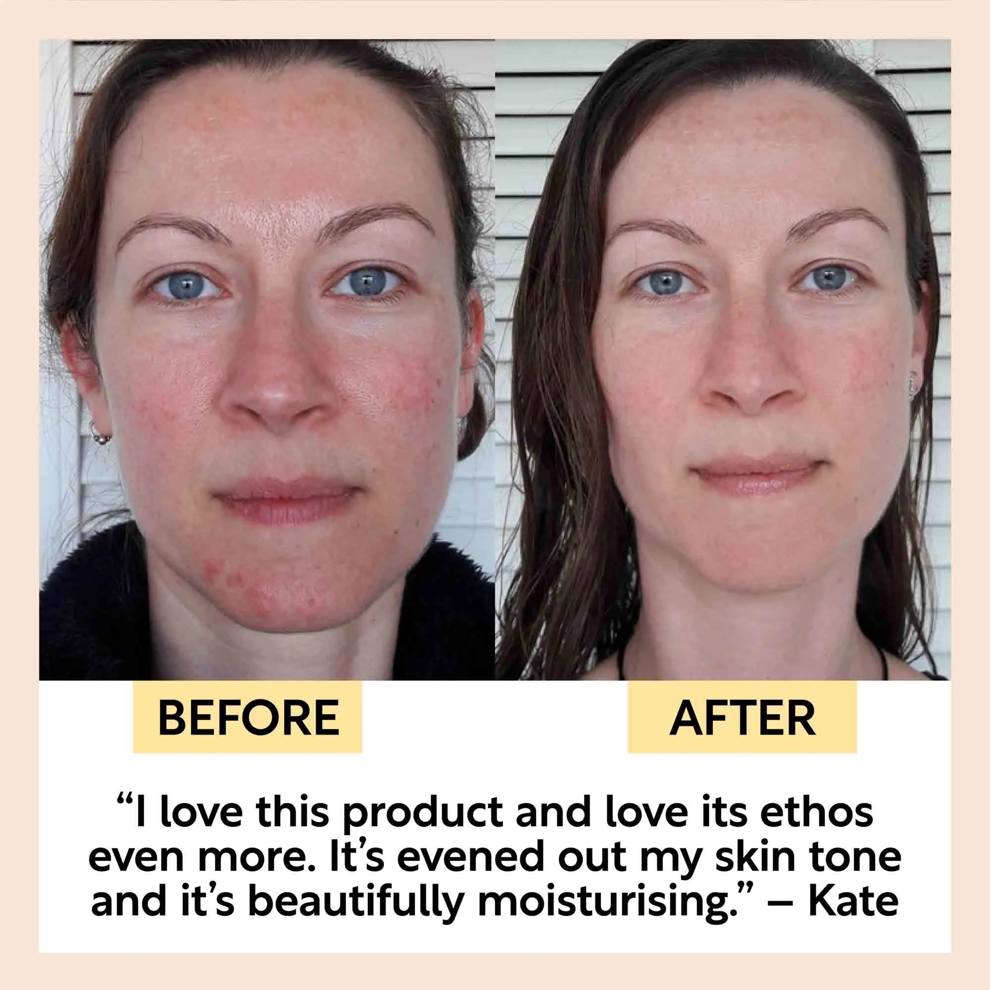 Anti-Aging Skincare Bundle gift set