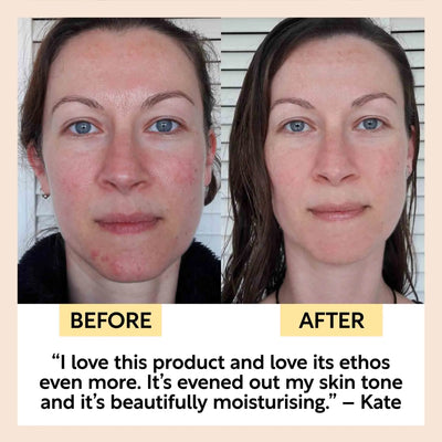 Anti-Aging Skincare Bundle gift set