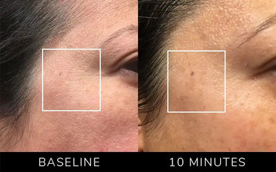 All-In-One Skincare Device beauty tool