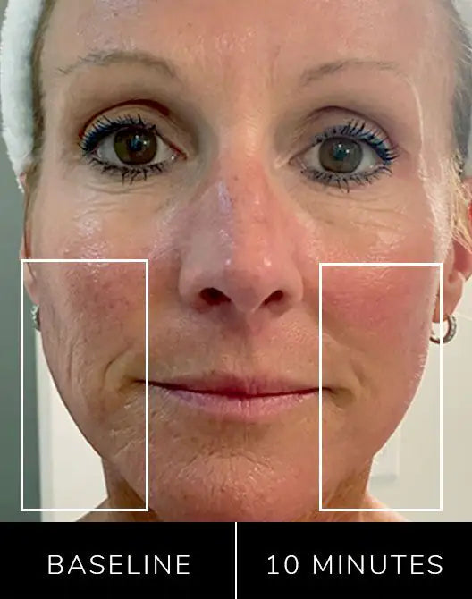 All-In-One Skincare Device beauty tool