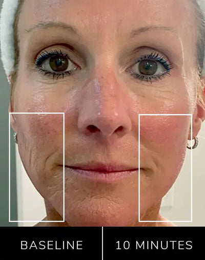 All-In-One Skincare Device beauty tool