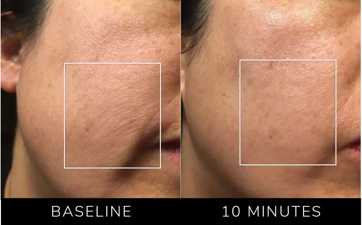 All-In-One Skincare Device beauty tool