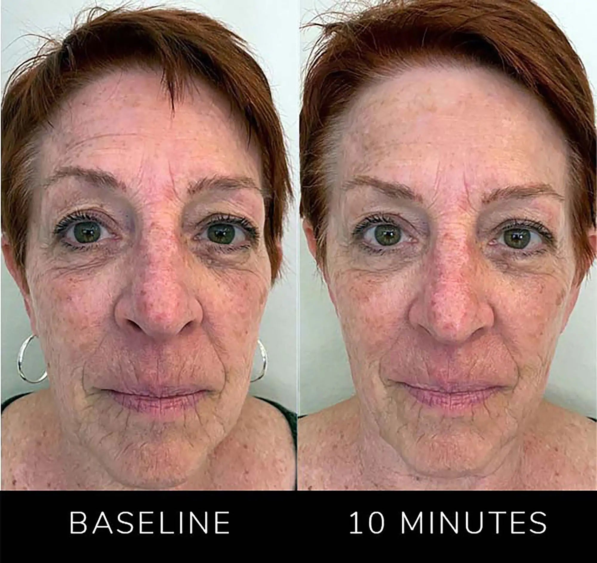 All-In-One Skincare Device beauty tool