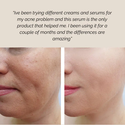 Botanical Face Serum serum